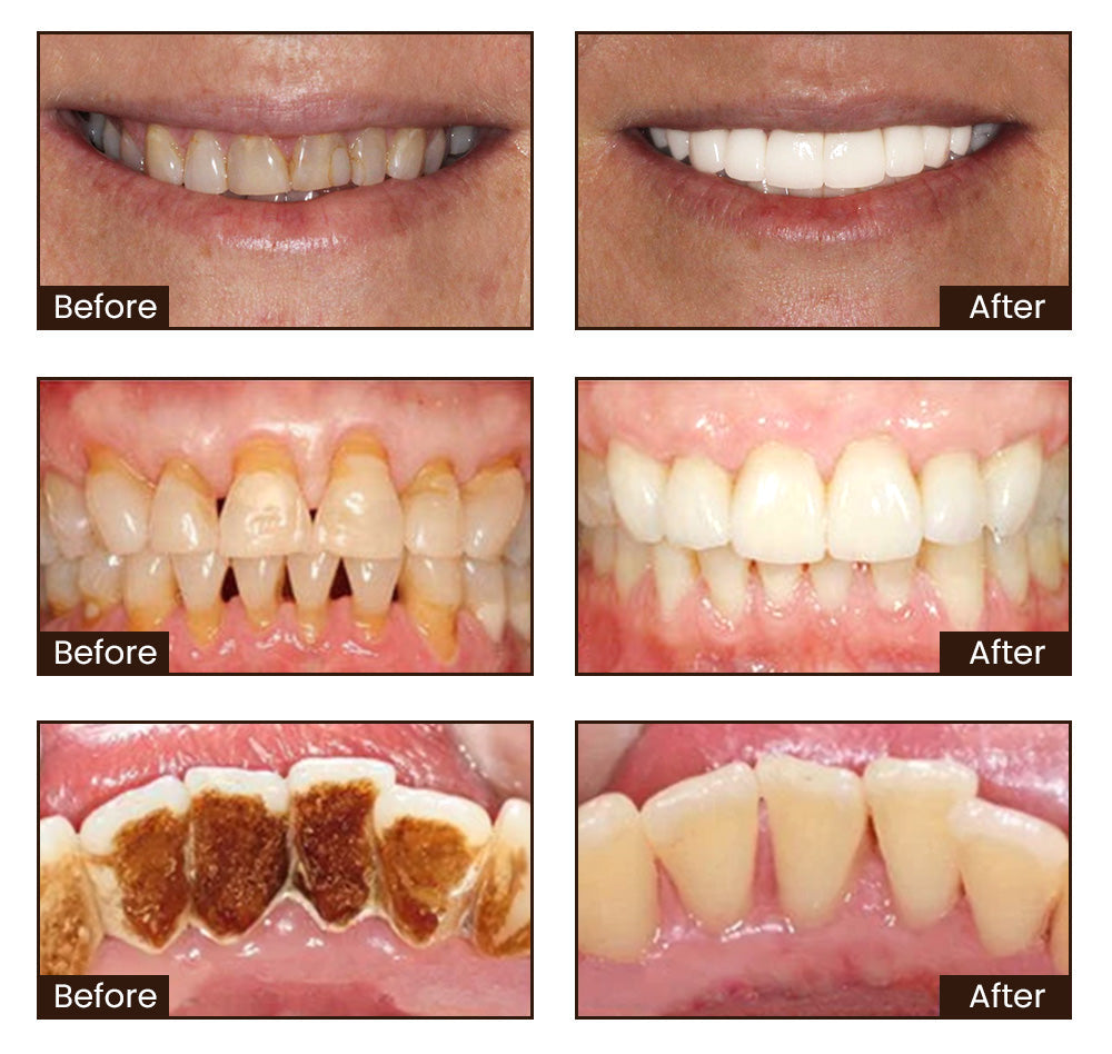 LOVILDS™ Whitening Toothpaste
