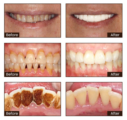 LOVILDS™ Whitening Toothpaste